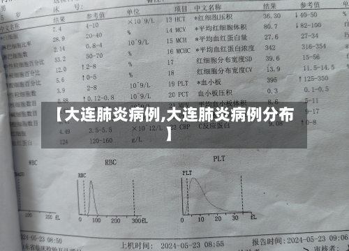 【大连肺炎病例,大连肺炎病例分布】-第2张图片