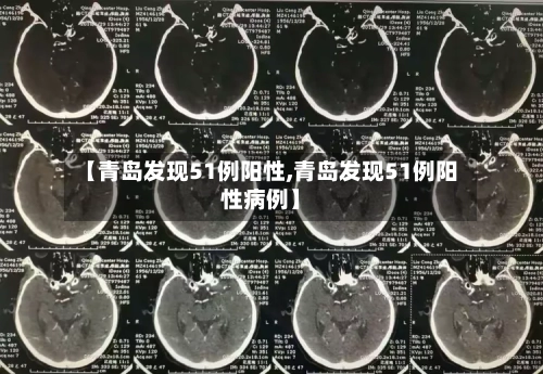 【青岛发现51例阳性,青岛发现51例阳性病例】